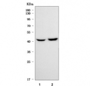 Western blot testing of 1) rat brain and 2) mouse brain tissue lysate with SLC25A23 antibody. Predicted molecular weight: 49-54 kDa (multiple isoforms).