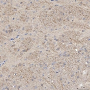 IHC staining of FFPE rat brain tissue with SLC25A23 antibody. HIER: boil tissue sections in pH8 EDTA for 20 min and allow to cool before testing.