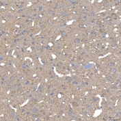 IHC staining of FFPE mouse brain tissue with SLC25A23 antibody. HIER: boil tissue sections in pH8 EDTA for 20 min and allow to cool before testing.