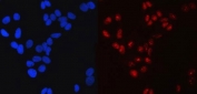 Immunofluorescent staining of FFPE human HeLa cells with Transcription factor SP1 antibody (red) and DAPI nuclear stain (blue). HIER: steam section in pH6 citrate buffer for 20 min.
