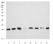 Western blot testing of 1) human HepG2, 2) human HeLa, 3) human PC-3, 4) monkey COS-7, 5) rat brain, 6) rat liver, 7) mouse brain and 8) mouse liver tissue lysate with PSMB7 antibody. Predicted molecular weight ~30 kDa.