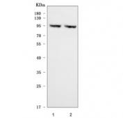 Western blot testing of human 1) SiHa and 2) HeLa cell lysate with CD105 antibody. Observed molecular weight: 70/90 kDa (monomer, unmodified/glycosylated); 140-180 kDa (dimer, unmodified/glycosylated).