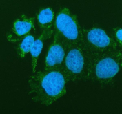 IHC staining of FFPE human right renal oncocytoma tissue with SIAE antibody. HIER: boil tissue sections in pH8 EDTA for 20 min and allow to cool before testing.