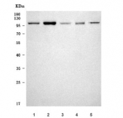 Western blot testing of 1) human placenta, 2) rat skeletal muscle, 3) rat ovary, 4) mouse skeletal muscle and 5) mouse C2C12 cell lysate with CAT2 antibody. Predicted molecular weight ~72 kDa but may be observed at higher molecular weights due to glycosylation.