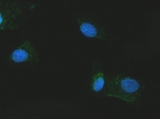 Immunofluorescent staining of FFPE human A549 cells with Citrin antibody (green) and DAPI nuclear stain (blue). HIER: steam section in pH6 citrate buffer for 20 min.