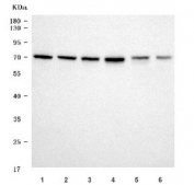 Western blot testing of 1) human Raji, 2) human A431, 3) human 293T, 4) human HepG2, 5) rat kidney and 6) rat liver tissue lysate with Citrin antibody. Predicted molecular weight ~74 kDa.