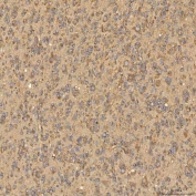 IHC staining of FFPE human brain tissue with Citrin antibody. HIER: boil tissue sections in pH8 EDTA for 20 min and allow to cool before testing.