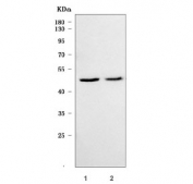 Western blot testing of 1) rat brain and 2) mouse brain tissue lysate with TSEN34 antibody. Predicted molecular weight ~34 kDa.