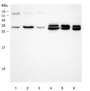 Western blot testing of 1) human 293T, 2) human HepG2, 3) human MCF7, 4) rat kidney, 5) rat liver and 6) mouse liver tissue lysate with Thiosulfate sulfurtransferase antibody. Predicted molecular weight ~33 kDa but may be observed at higher molecular weights due to glycosylation.