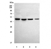 Western blot testing of human 1) HepG2, 2) HeLa, 3) 293T and 4) A549 cell lysate with ZIP7 antibody. Predicted molecular weight ~50 kDa.