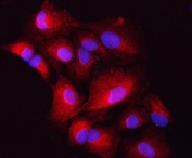 Immunofluorescent staining of FFPE human A549 cells with ZIP7 antibody (red) and DAPI nuclear stain (blue). HIER: steam section in pH6 citrate buffer for 20 min.