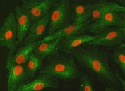 Immunofluorescent staining of FFPE human A549 cells with SNF2L2 antibody (red) and Beta Tubulin mAb (green). HIER: steam section in pH6 citrate buffer for 20 min.