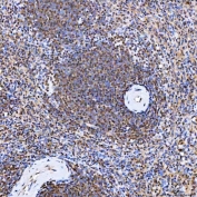IHC staining of FFPE human spleen tissue with SNF2L2 antibody. HIER: boil tissue sections in pH8 EDTA for 20 min and allow to cool before testing.