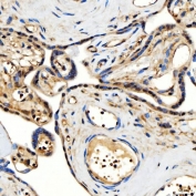 IHC staining of FFPE human placental tissue with SNF2L2 antibody. HIER: boil tissue sections in pH8 EDTA for 20 min and allow to cool before testing.