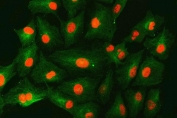 Immunofluorescent staining of FFPE human A549 cells with SNF2H antibody (red) and Beta Tubulin mAb (green). HIER: steam section in pH6 citrate buffer for 20 min.