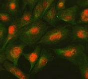 Immunofluorescent staining of FFPE human A549 cells with SMC2 antibody (red) and Beta Tubulin mAb (green). HIER: steam section in pH6 citrate buffer for 20 min.