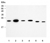 Western blot testing of 1) human Jurkat, 2) human 293T, 3) rat small intestine, 4) rat lung, 5) mouse RAW264.7 and 6) mouse NIH 3T3 cell lysate with Monocyte Chemotactic Protein 2 antibody. Predicted molecular weight ~11 kDa, higher molecular weight bands may represent dimerization.