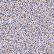 IHC staining of FFPE human spleen tissue with PAO-1 antibody. HIER: boil tissue sections in pH8 EDTA for 20 min and allow to cool before testing.