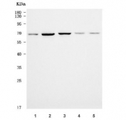 Western blot testing of 1) human A549, 2) human MCF7, 3) human HepG2, 4) rat spleen and 5) rat brain tissue lysate with PAO-1 antibody. Predicted molecular weight ~62 kDa.