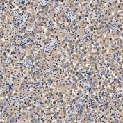 IHC staining of FFPE human testicular seminoma tissue with PAO-1 antibody. HIER: boil tissue sections in pH8 EDTA for 20 min and allow to cool before testing.