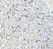 IHC staining of FFPE human testicular germ cell tumor tissue with CHGA antibody. HIER: boil tissue sections in pH8 EDTA for 20 min and allow to cool before testing.