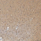 IHC staining of FFPE rat brain tissue with Syntaphilin antibody. HIER: boil tissue sections in pH8 EDTA for 20 min and allow to cool before testing.
