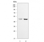 Western blot testing of human 1) 293T and 2) K562 cell lysate with Sorting Nexin 5 antibody. Predicted molecular weight ~47 kDa.