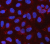 Immunofluorescent staining of FFPE human U-2 OS cells with CBLIF antibody (red) and DAPI nuclear stain (blue). HIER: steam section in pH6 citrate buffer for 20 min.