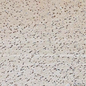 IHC staining of FFPE rat brain tissue with U2 snRNP A antibody. HIER: boil tissue sections in pH8 EDTA for 20 min and allow to cool before testing.