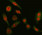Immunofluorescent staining of FFPE human SiHa cells with Sm-D2 antibody (red) and Beta Tubulin mAb (green). HIER: steam section in pH6 citrate buffer for 20 min.