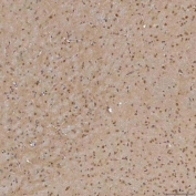 IHC staining of FFPE mouse brain tissue with Sm-D3 antibody. HIER: boil tissue sections in pH8 EDTA for 20 min and allow to cool before testing.