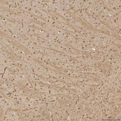 IHC staining of FFPE rat brain tissue with Sm-D3 antibody. HIER: boil tissue sections in pH8 EDTA for 20 min and allow to cool before testing.