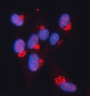 Immunofluorescent staining of FFPE human U-87 MG cells with Snurportin 1 antibody (red) and DAPI nuclear stain (blue). HIER: steam section in pH6 citrate buffer for 20 min.