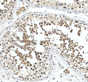 IHC staining of FFPE human testis tissue with Snurportin 1 antibody, HRP-secondary and DAB substrate. HIER: boil tissue sections in pH8 EDTA for 20 min and allow to cool before testing.