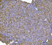 IHC staining of FFPE mouse ovary tissue with Retinol Binding Protein 1 antibody. HIER: boil tissue sections in pH8 EDTA for 20 min and allow to cool before testing.