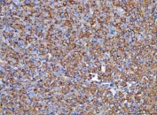 IHC staining of FFPE rat ovary tissue with Retinol Binding Protein 1 antibody. HIER: boil tissue sections in pH8 EDTA for 20 min and allow to cool before testing.