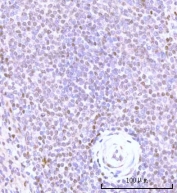 IHC staining of FFPE human spleen rupture tissue with Nesprin 3 antibody. HIER: boil tissue sections in pH8 EDTA for 20 min and allow to cool before testing.
