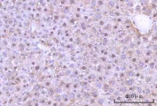 IHC staining of FFPE human mouse liver tissue with Nesprin 3 antibody. HIER: boil tissue sections in pH8 EDTA for 20 min and allow to cool before testing.