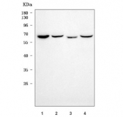 Western blot testing of 1) human HL60, 2) human MCF7, 3) rat lung and 4) rat kidney tissue lysate with Sorting nexin 18 antibody. Predicted molecular weight: ~69/69/65 kDa (three isoforms).