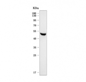 Western blot testing of human RT4 cell lysate with Sorting nexin 31 antibody. Predicted molecular weight ~51 kDa.