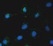 Immunofluorescent staining of FFPE human A549 cells with Sorting nexin 1 antibody (green) and DAPI nuclear stain (blue). HIER: steam section in pH6 citrate buffer for 20 min.