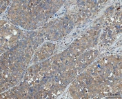 IHC staining of FFPE human liver tissue with Sorting nexin 1 antibody. HIER: boil tissue sections in pH8 EDTA for 20 min and allow to cool before testing.