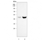 Western blot testing of human 1) HeLa and 2) MCF7 cell lysate with Sorting nexin 15 antibody. Predicted molecular weight ~38 KDa and ~29 kDa (two isoforms), commonly observed at 38-50 kDa.