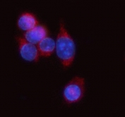 Immunofluorescent staining of FFPE mouse RAW264.7 cells with Antigen peptide transporter 1 antibody (red) and DAPI nuclear stain (blue). HIER: steam section in pH6 citrate buffer for 20 min.
