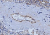 IHC staining of FFPE human spleen tissue with Thrombomodulin antibody. HIER: boil tissue sections in pH8 EDTA for 20 min and allow to cool before testing.
