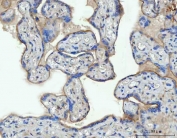 IHC staining of FFPE human placental tissue with Thrombomodulin antibody. HIER: boil tissue sections in pH8 EDTA for 20 min and allow to cool before testing.