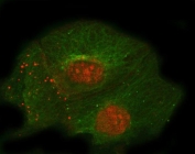 Immunofluorescent staining of FFPE human A431 cells with Thrombomodulin antibody (red) and Alpha Tubulin mAb (green). HIER: steam section in pH6 citrate buffer for 20 min.