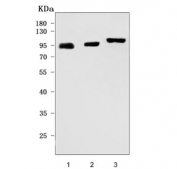 Western blot testing of 1) human RT4, 2) human A431 and 3) rat PC-12 cell lysate with Thrombomodulin antibody. Expected molecular weight: 60-100 kDa depending on glycosylation.