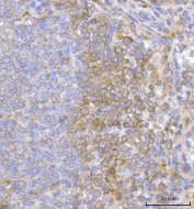 IHC staining of FFPE human spleen tissue with Hamartin antibody. HIER: boil tissue sections in pH8 EDTA for 20 min and allow to cool before testing.