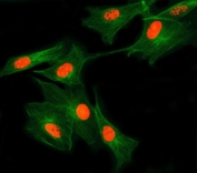 Immunofluorescent staining of FFPE human U-87 MG cells with SNRNP27 antibody (red) and Beta Tubulin mAb (green). HIER: steam section in pH6 citrate buffer for 20 min.